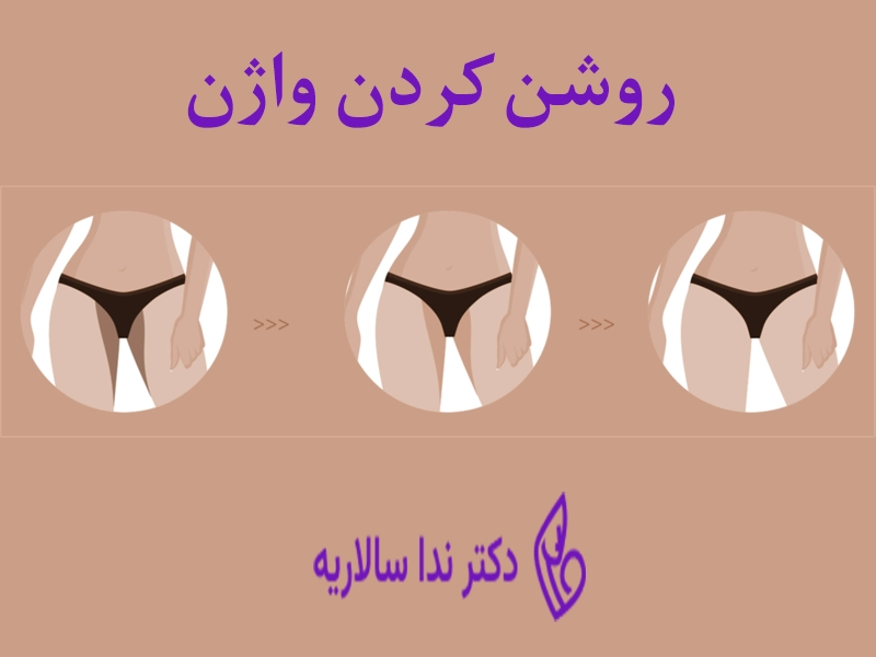 راه‌های روشن کردن واژن