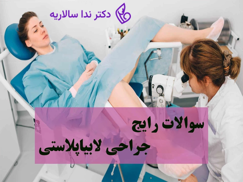 سوالات متداول لابیاپلاستی