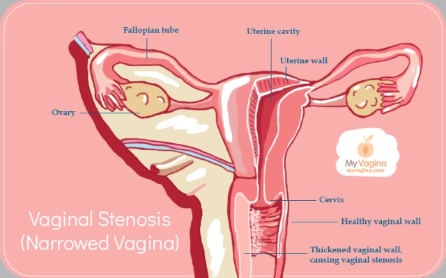 عمل تنگ کردن واژن در شمال تهران