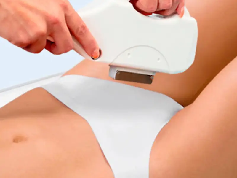 آیا لیزر برای رفع تیرگی واژن مفید است؟