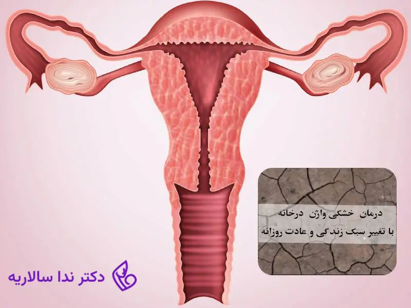  درمان خشکی واژن در خانه با تغییر سبک زندگی و عادات روزانه