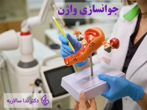 جوانسازی واژن
